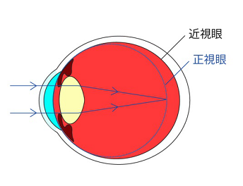 愛眼日如期而至，關(guān)注孩子眼睛健康，讓他們擁有一個光明未來！