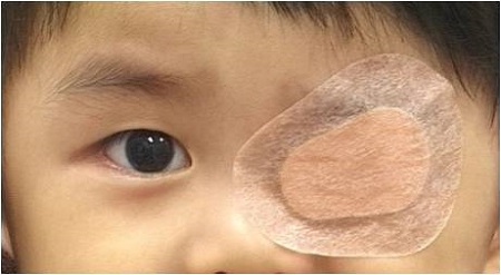 孩子看東西老喜歡斜著眼，“打一頓”就能好嗎？