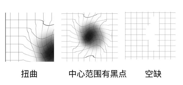 眼睛出現(xiàn)這幾種癥狀，黃斑變性很可能已經(jīng)找上你了！別拖趕緊治療