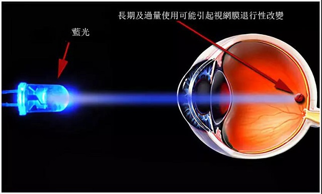 手機“護(hù)眼模式”反而會傷眼？竟和這個原因有關(guān)，大多數(shù)人沒想到！