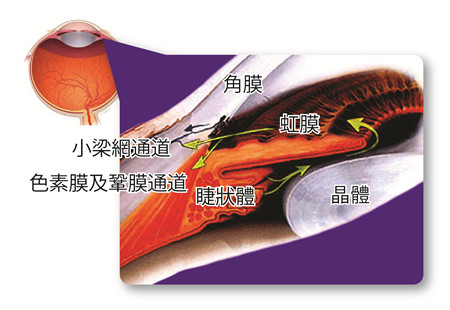 青光眼患者應(yīng)該積極治療
