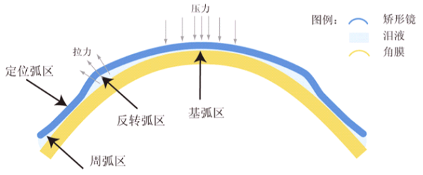 怕孩子度數猛增？除了開啟APP青少年模式，還有一招可控制！
